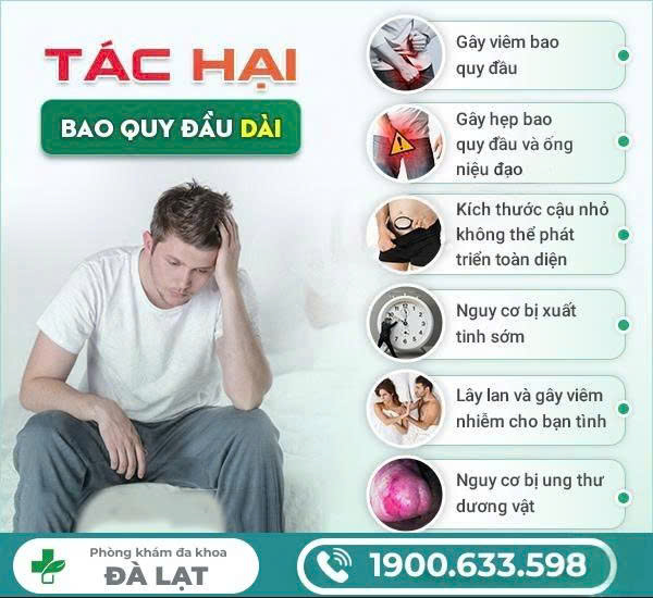 Hình ảnh minh họa